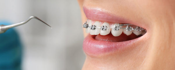 orthodontiste