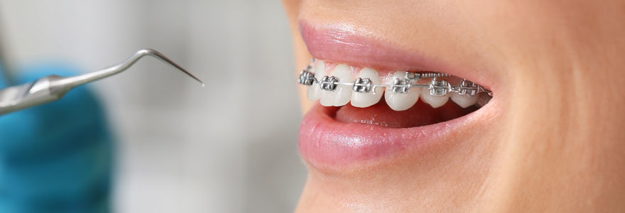 orthodontiste